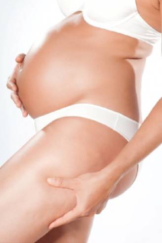 cellulite-in-gravidanza