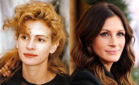 Julia-Roberts-Before-and-After-Plastic-Surgery