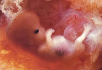 Embrione-umano