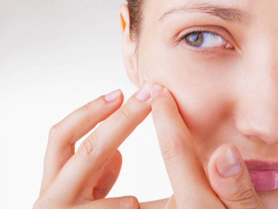 Acne: la posizione dei tuoi brufoli indica il tuo stato di salute