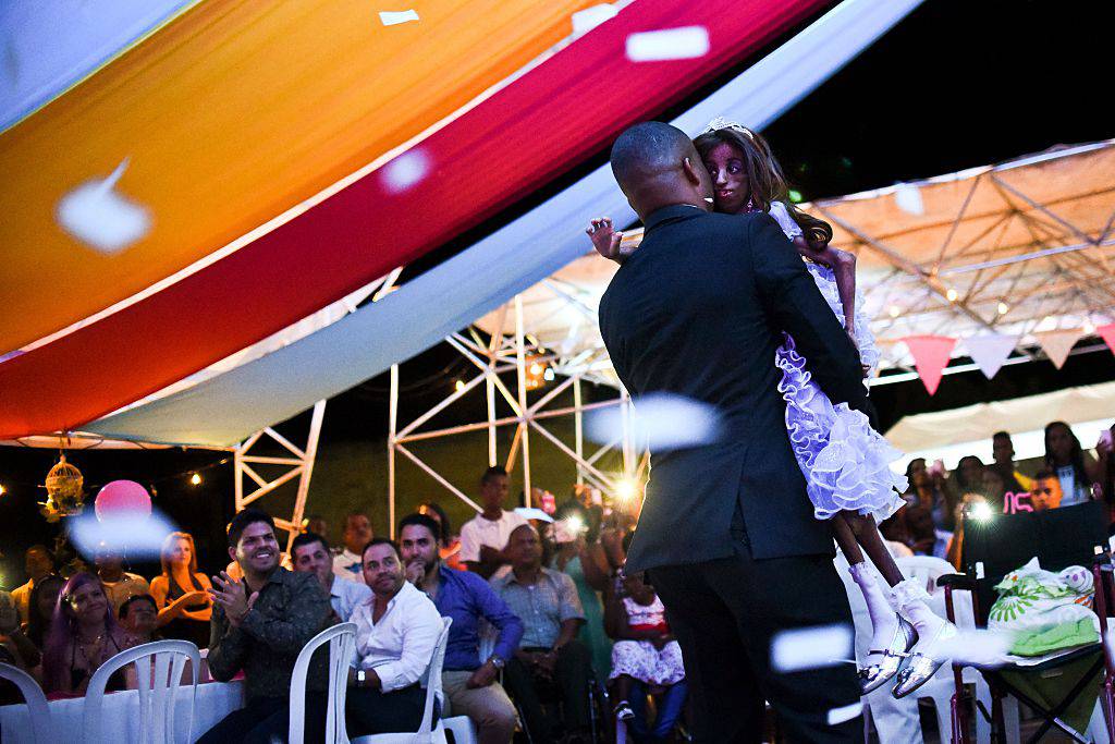 Colombian Magali Gonzalez Sierra, 15,dances with father Jose Eider Gonzalez during her 15th birthday party in El Cabuyal, department of Valle del Cauca, Colombia, on January 16, 2016. Magali suffers from Hutchinson-Gilford progeria syndrome, a disease that causes premature aging in children, whose average lifespan is 13 years old. Magali's dream of celebrating her 15th birthday with a big party is today fulfilled with the help of neighbors and friends. AFP PHOTO / LUIS ROBAYO / AFP / LUIS ROBAYO (Photo credit should read LUIS ROBAYO/AFP/Getty Images)