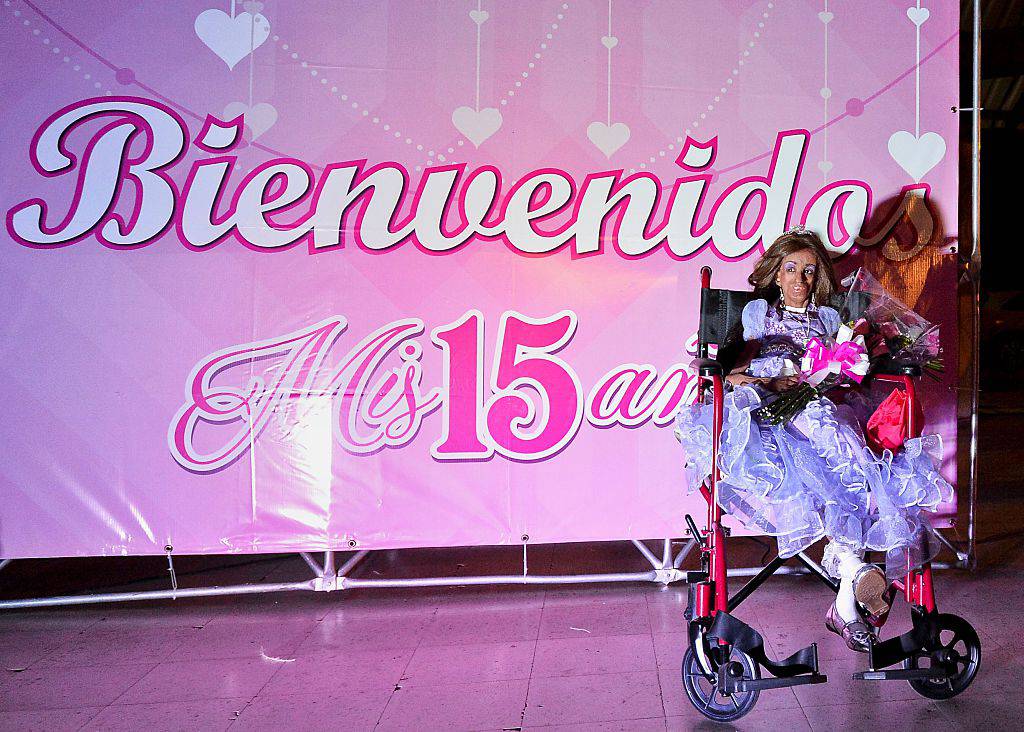 Colombian Magali Gonzalez Sierra, 15, attends her 15th birthday party in El Cabuyal, department of Valle del Cauca, Colombia, on January 16, 2016. Magali suffers from Hutchinson-Gilford progeria syndrome, a disease that causes premature aging in children, whose average lifespan is 13 years old. Magali's dream of celebrating her 15th birthday with a big party is today fulfilled with the help of neighbors and friends. AFP PHOTO / LUIS ROBAYO / AFP / LUIS ROBAYO (Photo credit should read LUIS ROBAYO/AFP/Getty Images)