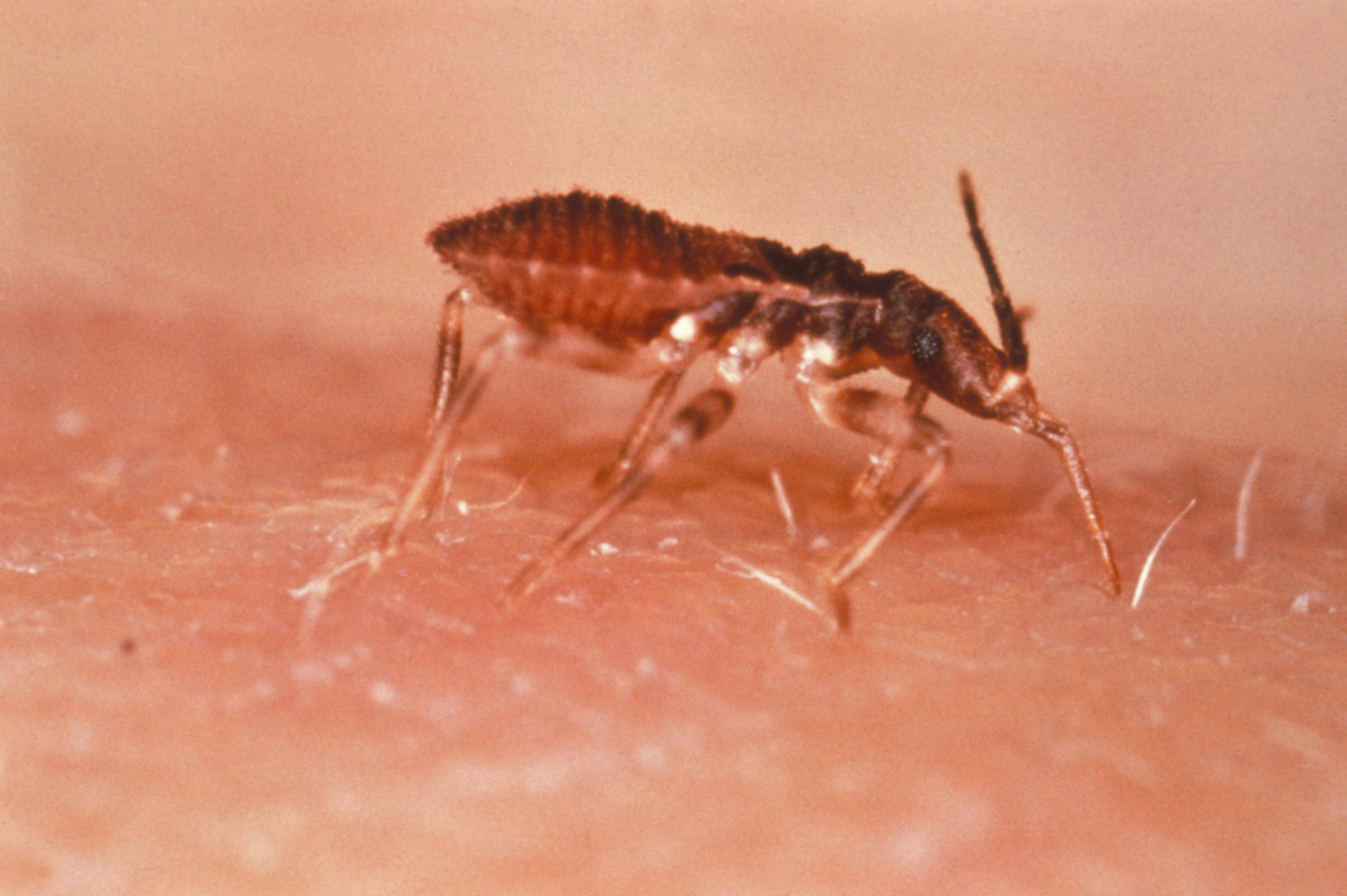 malattia Chagas
