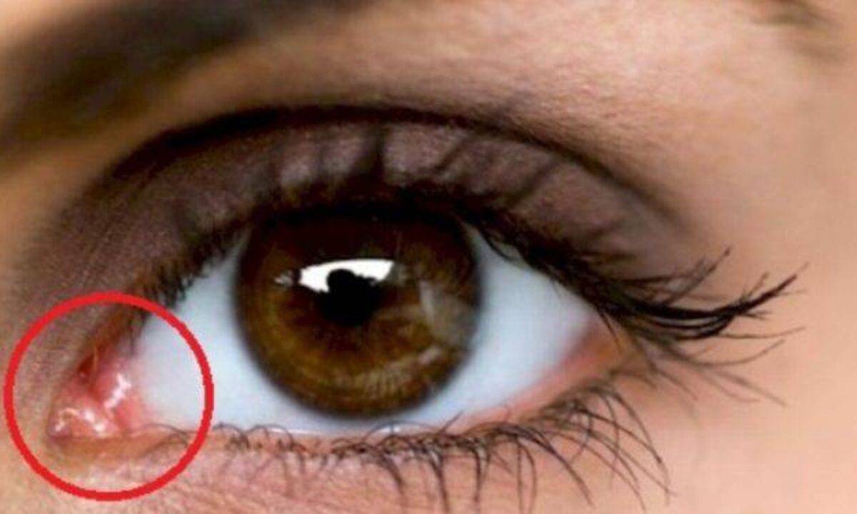 Occhio Secco L Importanza Della Membrana Nittitante Occhio Secco L Importanza Della Membrana Nittitante