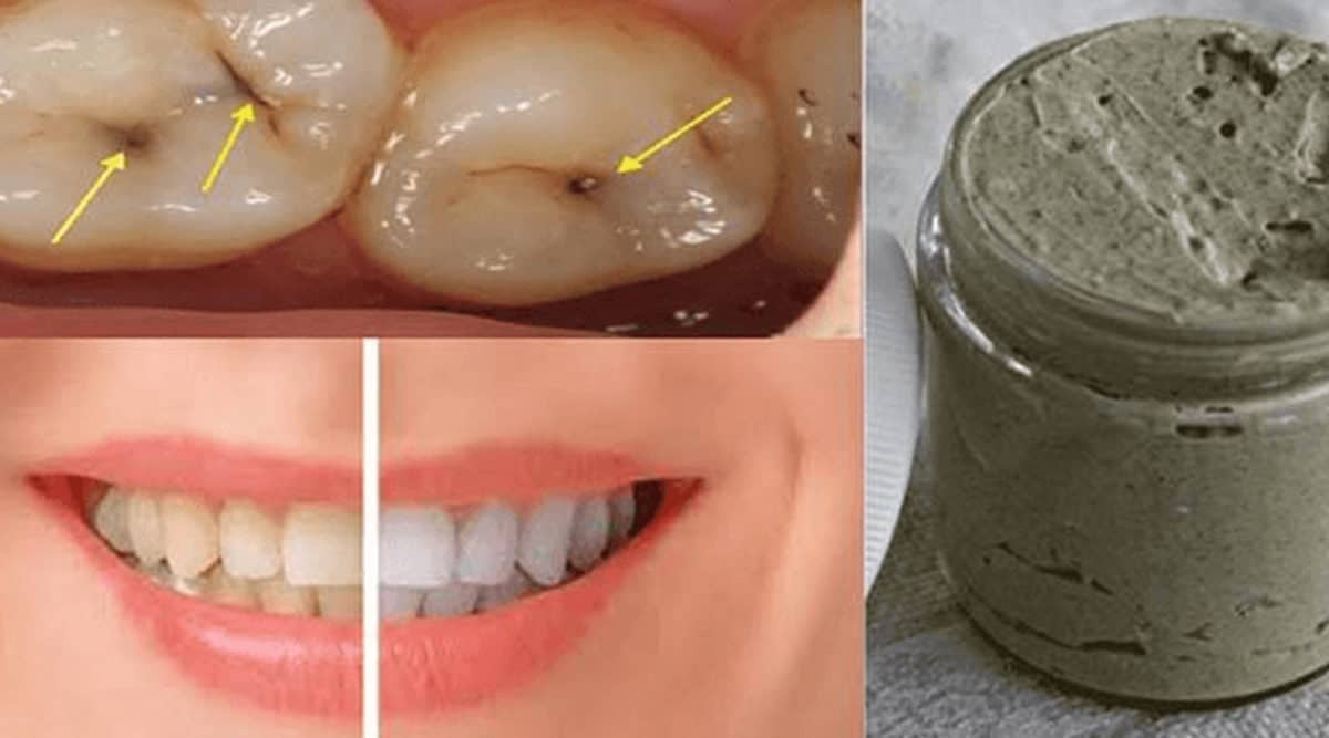 Dentifricio fatto in casa che sbianca i denti e cura la carie