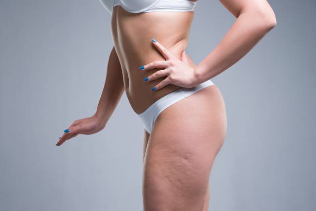 6 oli essenziali contro la cellulite