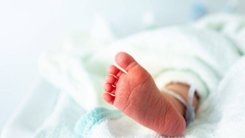 ectopia cordis salvata neonata