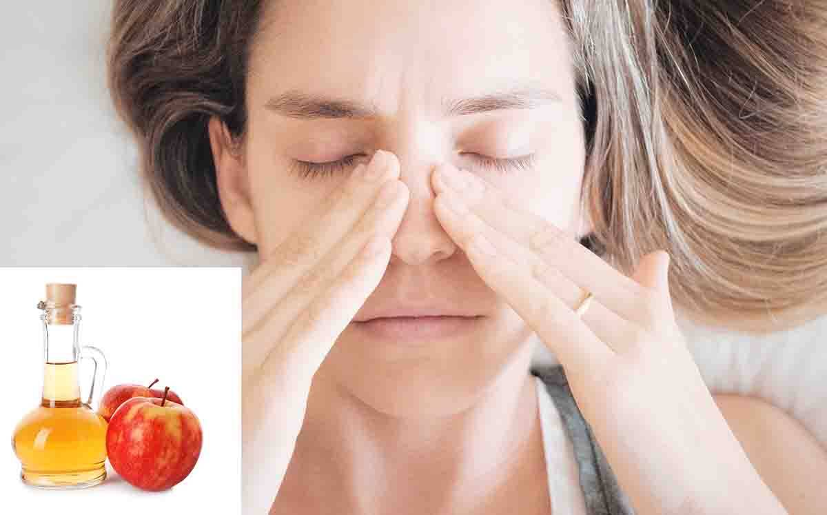 rimedi naturali sinusite