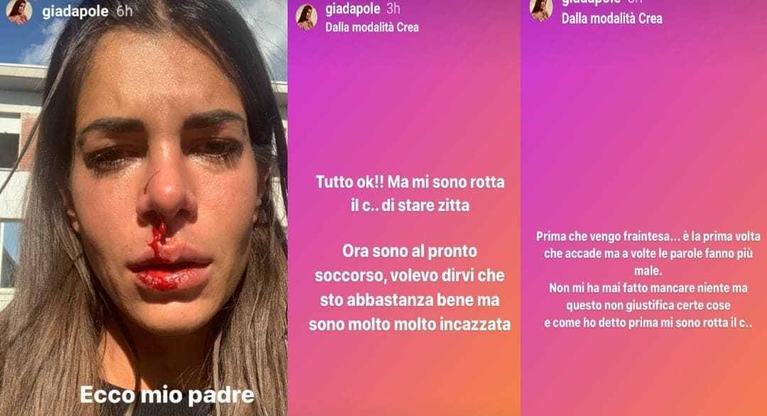Giada Giovannelli la verità su instagram 