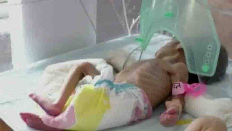 neonata seppellita viva India