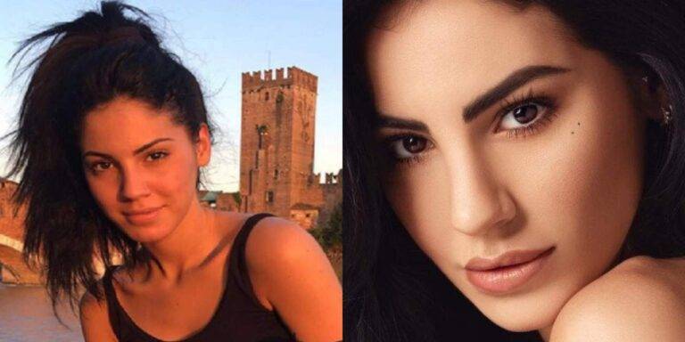 Transgender Uomini E Donne Prima E Dopo