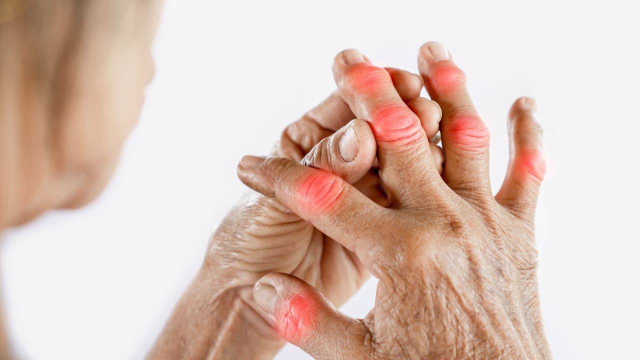 artrite sintomi