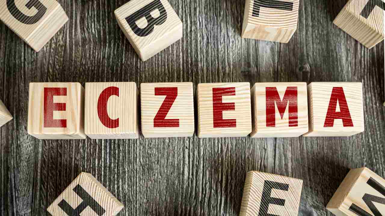 eczema cos'è cause sintomi