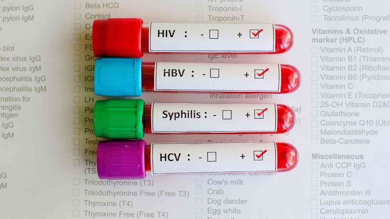 sesso hiv