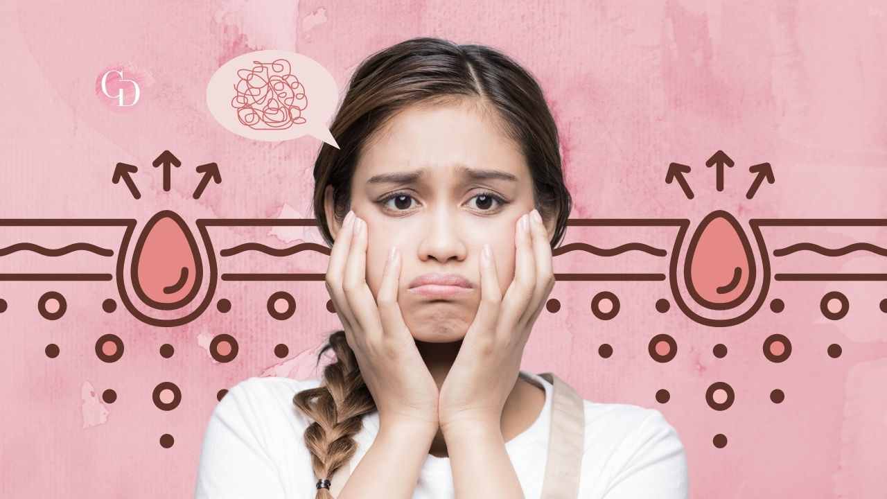 posizione brufoli viso