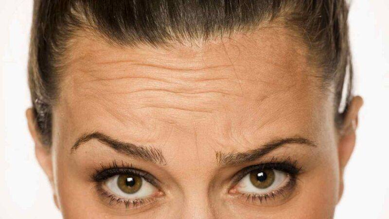 Rughe profonde sulla fronte? Prova questi rimedi della nonna infallibili