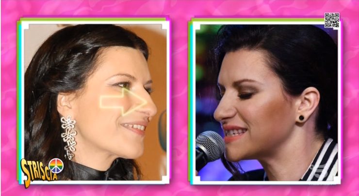 laura pausini prima e dopo