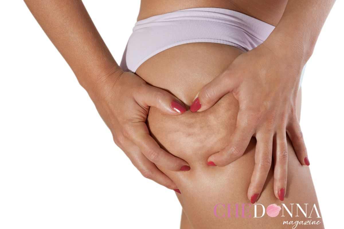 cellulite rimedio casalingo