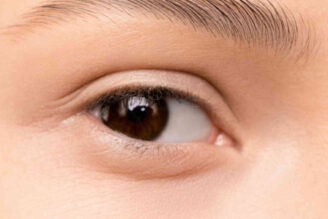 Contorno occhi